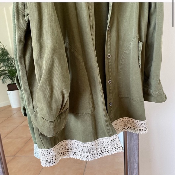 Zara Mixed Lace Overshirt - Picture 7 of 9